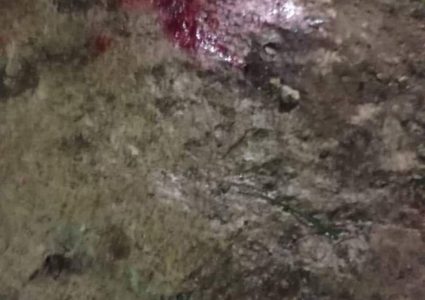 إصابة مواطن عقب انفجار قنبلة من مخلفات الاحتلال جنوب الخليل