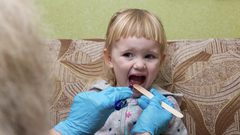 بريطانيا شهدت عام 2022 أكبر انتشار للحمى القرمزية منذ 70 عاما