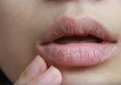 ما الأسباب التي تؤدي لجفاف الفم؟