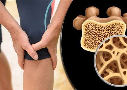 طرق الوقاية من هشاشة العظام