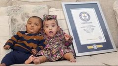 ولادة قبل الأوان.. رقم قياسي بمدة الحمل يدخل موسوعة "غينيس"