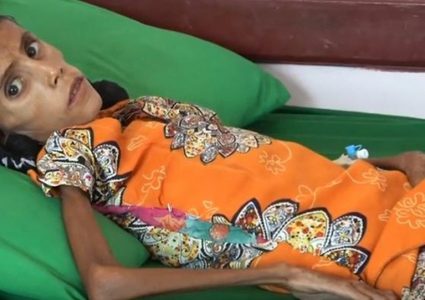 اليونيسف تقرع ناقوس الخطر: أكثر من مليار فتاة مراهقة وامرأة يعانين من نقص التغذي