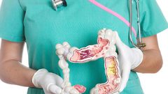 مستشفى النجاح يعلن عن استمرار الحملة المجانية للكشف عن سرطان القولون والمستقيم