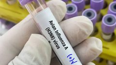 الصين تسجل أول حالة وفاة بمتحور جديد من إنفلونزا الطيور