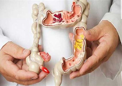 دراسة جديدة تكشف سببًا صادمًا للإصابة بسرطان الجهاز الهضمي