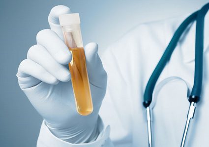 مشاكل صحية خطيرة يدل عليها التبول المتكرر