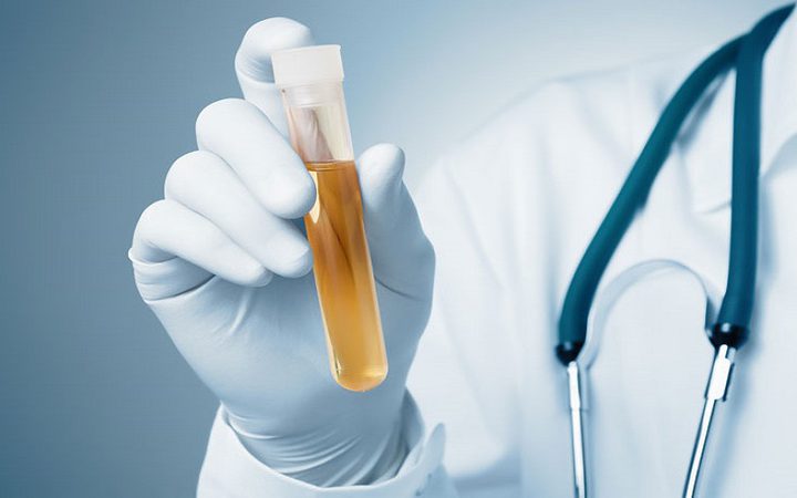 مشاكل صحية خطيرة يدل عليها التبول المتكرر