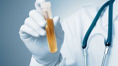 مشاكل صحية خطيرة يدل عليها التبول المتكرر