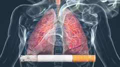 أخصائي يكشف مدة التدخين المسببة للانسداد الرئوي المزمن