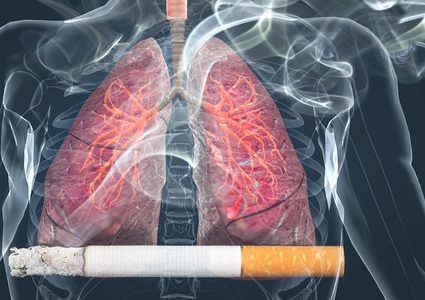 أخصائي يكشف مدة التدخين المسببة للانسداد الرئوي المزمن