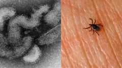 اليابان: تسجيل أول وفاة بفيروس أوز Oz