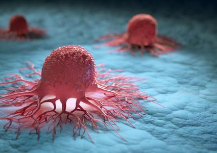 ما هي العلامات غير الشائعة التي تكشف الإصابة بالسرطان ؟