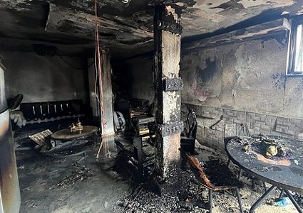 إصابة خطيرة جراء حريق داخل منزل في رهط