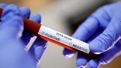 بريطانيا: اكتشاف نوع جديد من فيروس كورونا لديه قدرة كبيرة على التحور