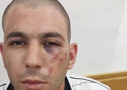 شرطة الاحتلال تعتدي على شاب من مخيم شعفاط وتحوله للاعتقال المنزلي