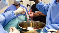 للمرة الثانية في أقل من عامين: زرع قلب خنزير في جسم إنسان