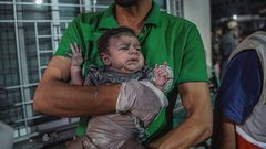 عدد من الأطفال المصابين بقصف طائرات الاحتلال في قطاع غزة