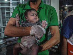 عدد من الأطفال المصابين بقصف طائرات الاحتلال في قطاع غزة