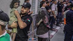 عدد من الأطفال المصابين بقصف طائرات الاحتلال في قطاع غزة