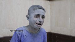 صور من مستشفيات غزة التي تمتلئ بالشهداء والمصابين نتيجة العدوان الإسرائيلي