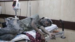 صور من مستشفيات غزة التي تمتلئ بالشهداء والمصابين نتيجة العدوان الإسرائيلي