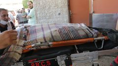 صور من مستشفيات غزة التي تمتلئ بالشهداء والمصابين نتيجة العدوان الإسرائيلي