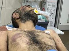 متابعة| صور آثار الضرب والتعذيب على جثمان الشهيد وسيم عياش