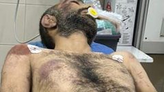 صور آثار الضرب والتعذيب على جثمان الشهيد وسيم عياش من بلدة رافات في سلفيت