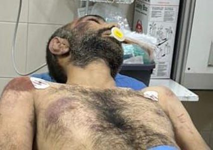 صور آثار الضرب والتعذيب على جثمان الشهيد وسيم عياش من بلدة رافات في سلفيت