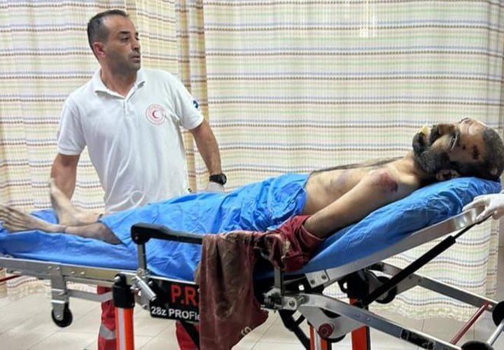 متابعة| صور آثار الضرب والتعذيب على جثمان الشهيد وسيم عياش