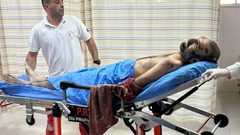 صور آثار الضرب والتعذيب على جثمان الشهيد وسيم عياش من بلدة رافات في سلفيت