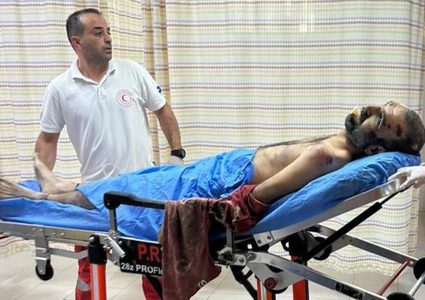 صور آثار الضرب والتعذيب على جثمان الشهيد وسيم عياش من بلدة رافات في سلفيت