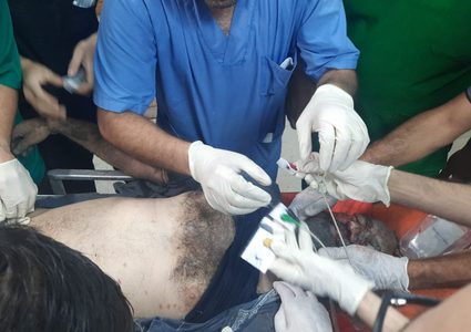 حالات ومشاهد مأساوية من المستشفى الإندونيسي شمال غزة مع استمرار القصف