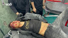 شهداء وإصابات معظمها من الأطفال بعد قصف منزل لعائلة أبو ربيع في رفح