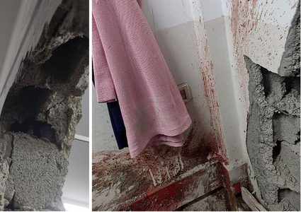 شهيدة وعدة إصابات في قصف للاحتلال استهدف مجمع ناصر الطبي بخان يونس