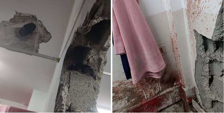 شهيدة وعدة إصابات في قصف للاحتلال استهدف مجمع ناصر الطبي بخان يونس