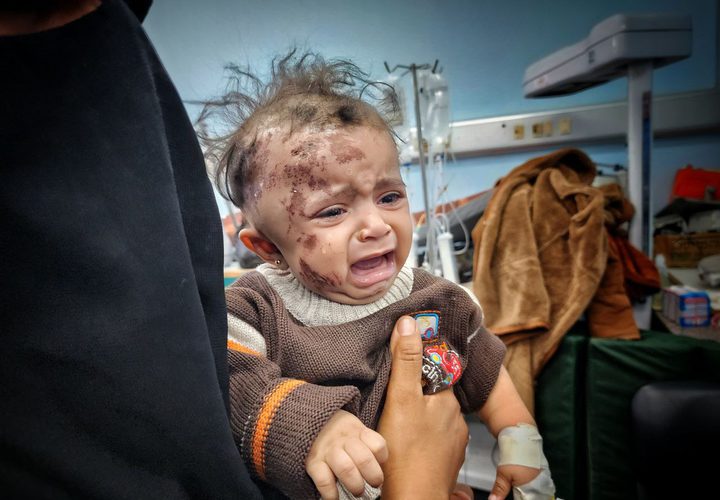 أطفال أصيبوا في غارات الاحتلال على غزة