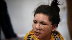 شاهد| أطفال أصيبوا في غارات الاحتلال على غزة