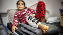 أطفال أصيبوا في غارات الاحتلال على غزة