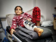 أطفال أصيبوا في غارات الاحتلال على غزة