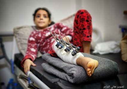 شاهد| أطفال أصيبوا في غارات الاحتلال على غزة