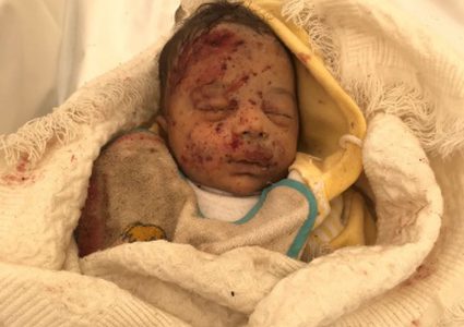 أطباء بلا حدود: لا أحد ولا مكان آمن في غزة