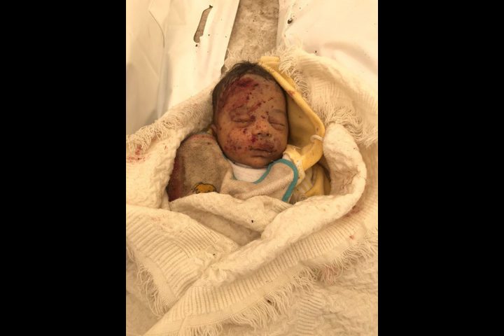 أطباء بلا حدود: لا أحد ولا مكان آمن في غزة