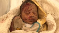 أطباء بلا حدود: لا أحد ولا مكان آمن في غزة