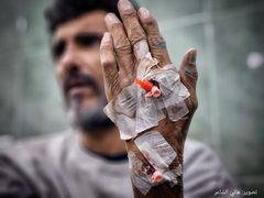 معتقلون من غزة تعرضوا للتعذيب قبل إفراج الاحتلال عنهم عبر معبر كرم أبو سالم.