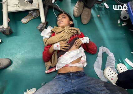 نقل 3 شهداء وإصابات إلى مستشفى أبو يوسف النجار في رفح جراء قصف الاحتلال