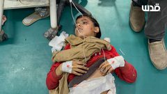 نقل 3 شهداء وإصابات إلى مستشفى أبو يوسف النجار في رفح جراء قصف الاحتلال