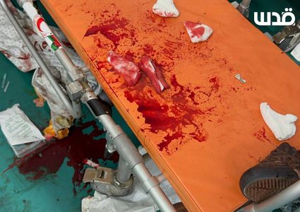 نقل 3 شهداء وإصابات إلى مستشفى أبو يوسف النجار في رفح جراء قصف الاحتلال منطقة المواصي غربي خانيونس