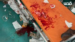 نقل 3 شهداء وإصابات إلى مستشفى أبو يوسف النجار في رفح جراء قصف الاحتلال