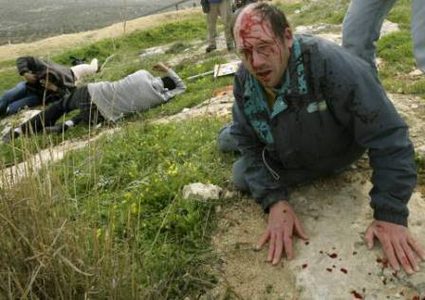 إصابة متضامنين أجنبيين بجروح في اعتداء للمستوطنين بمسافر يطا